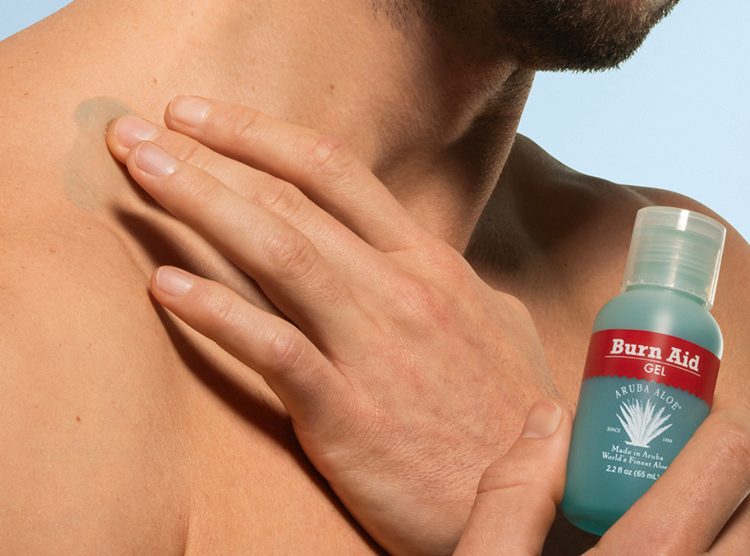 Burn Aid Gel | Body | Aruba Aloe